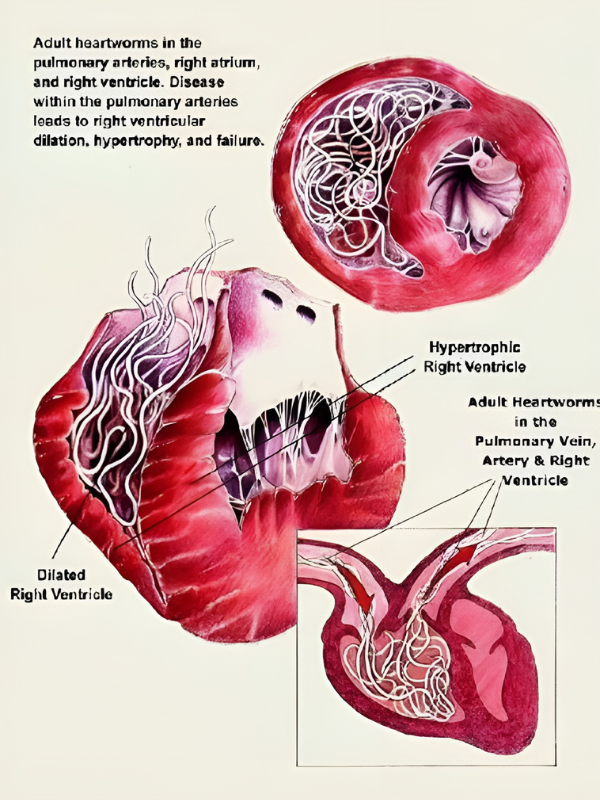 heart diagram